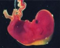 EQUIPO OBSTETRICO
Unidad Perinatal
Diagnstico Pre-Natal
Tamizaje prenatal de defectos congnitos
TRANSLUCENCIA NUCAL